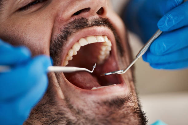 Best Emergency Dental Care for Trauma or Injury in Kearney, MO