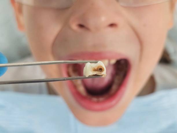 Best Emergency Dental Care for Trauma or Injury in Kearney, MO